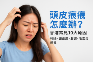 頭皮痕癢怎麼辦：香港常見10大原因（乾燥、頭皮屑、脂漏、毛囊炎、過敏）、止癢急救、洗頭水挑選與就醫時機一次搞懂