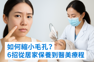 如何縮小毛孔？6招從居家保養到醫美療程全攻略：去角質、控油保濕、防曬、酸類A醇、微針射頻與雷射改善粗大毛孔一次搞懂