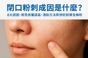 閉口粉刺成因是什麼？8大誘因、常見保養誤區、清除方法與預防對策全解析