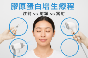 膠原蛋白增生療程：香港注射vs射頻vs雷射全比較，原理、效果、適合對象、價錢、療程次數、恢復期、副作用、維持期與護理