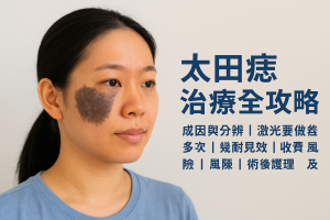 太田痣治療全攻略：成因與分辨、激光要做幾多次、幾耐見效、收費、風險、術後護理與復發機會