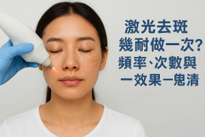 激光去斑幾耐做一次？頻率、次數與效果一次睇清