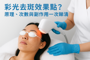 彩光去斑效果點？原理、次數與副作用一次睇清
