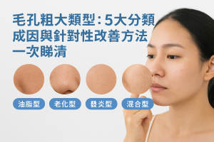 毛孔粗大類型：5大分類、成因與針對性改善方法一次睇清