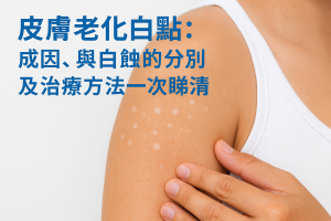 皮膚老化白點：成因、與白蝕的分別及治療方法一次睇清